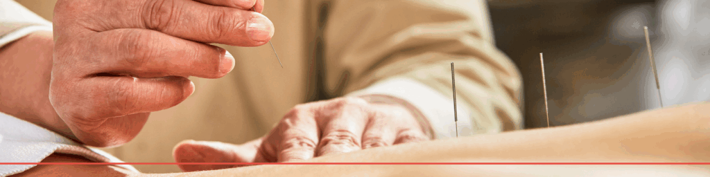 acupuntura